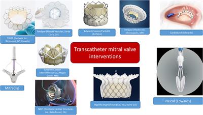 Multimodality Imaging in Transcatheter Mitral Interventions